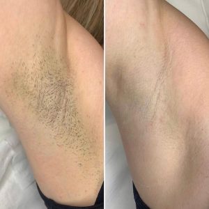 KEVA MASK Collagen – 25g